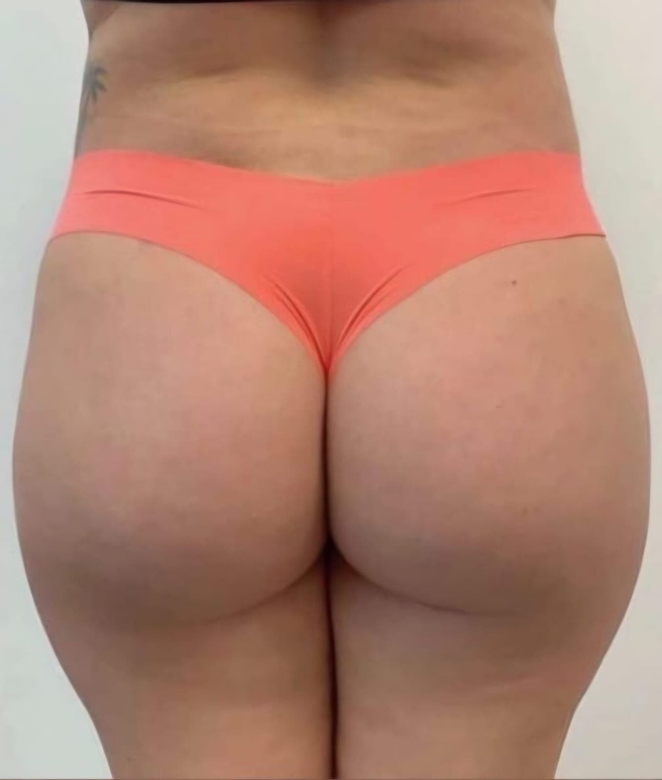 Dopo